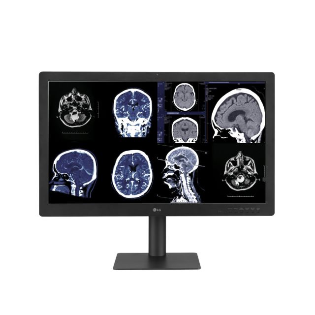 Η νέα διαγνωστική οθόνη της LG με τεχνολογία IPS Black παρέχει εγγυημένη ποιότητα εικόνας