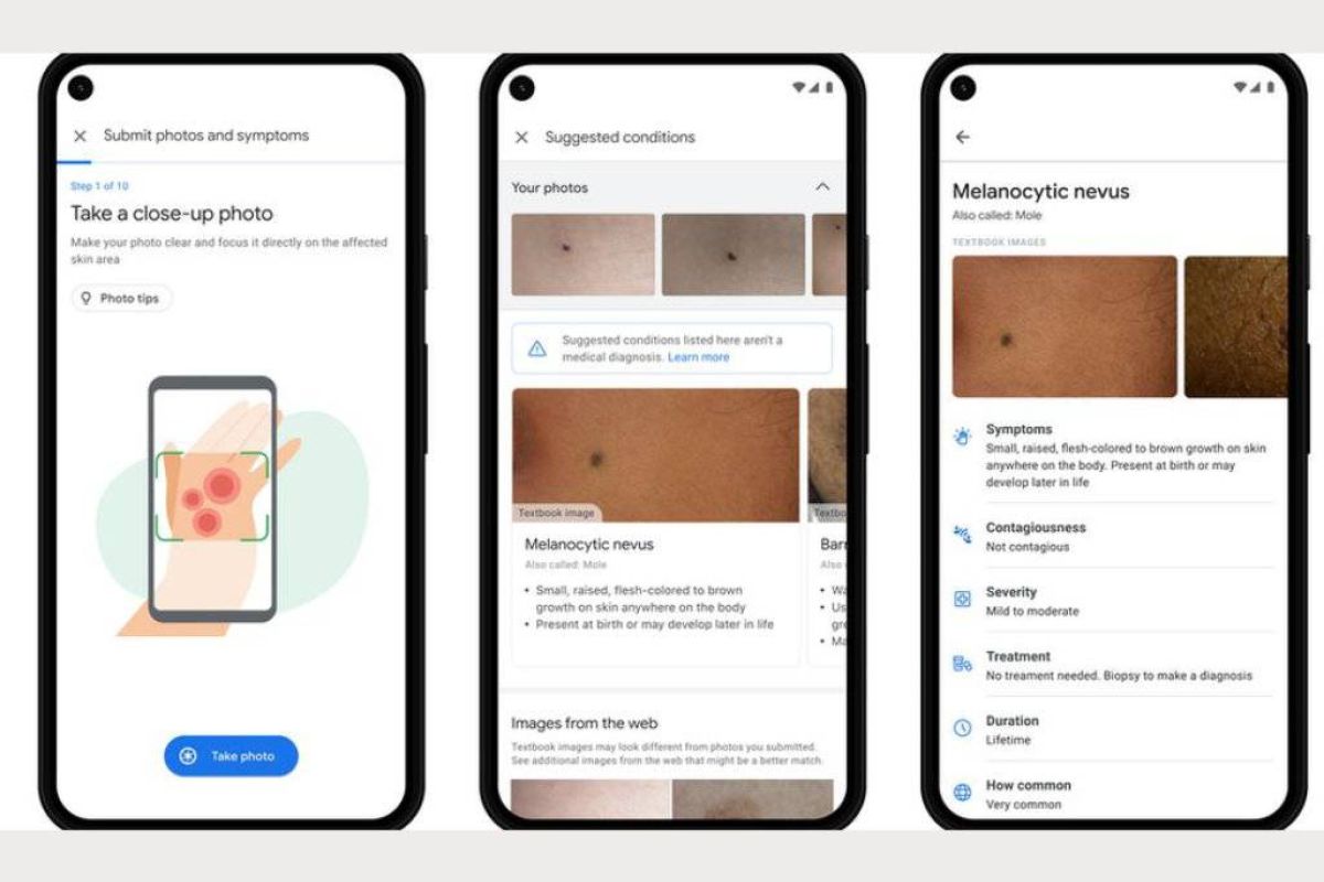 ea5f2786e7ba81c649efca9b3c61aadf XL 7394e6c3