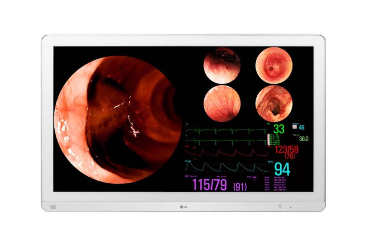 295d0a21b38c345498e132a2577ecc1b XL 81d29ece