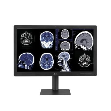 Η νέα διαγνωστική οθόνη της LG με τεχνολογία IPS Black παρέχει εγγυημένη ποιότητα εικόνας