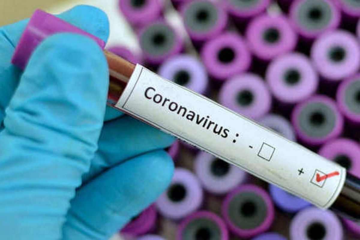 d5862617f76838b614af8dc16be804c0 XL a1024a8c