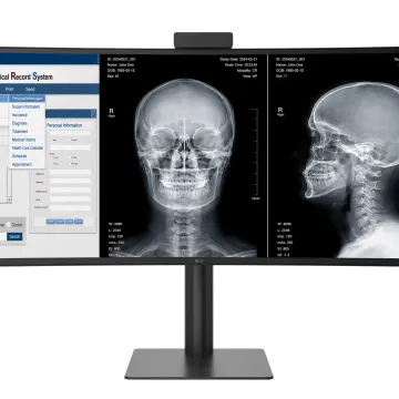 Η LG ELECTRONICS ΠΑΡΟΥΣΙΑΖΕΙ ΤΗΝ CURVED ULTRAWIDE ΔΙΑΓΝΩΣΤΙΚΗ ΟΘΟΝΗ 40 ΙΝΤΣΩΝ ΜΕ ΕΓΚΡΙΣΗ FDA
